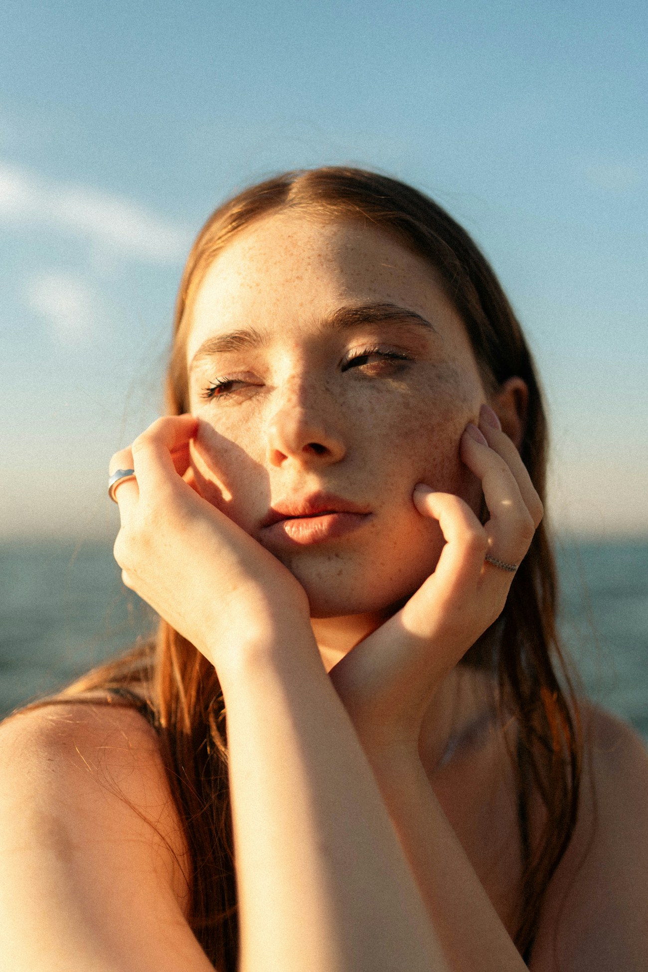 Skin